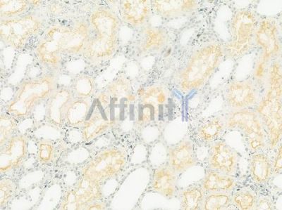 SLC6A20 Antibody - DF9926 at 1/100 staining human normal kidney tissue by IHC-P.