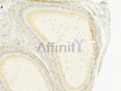 SLC6A20 Antibody - DF9926 at 1/100 staining human testicular cancer by IHC-P.