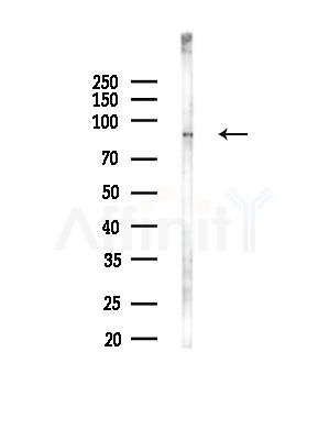 SLC9A5 Antibody - Western blot analysis of lysates from PC12 cells(LPS,4h treatment), using SLC9A5 Antibody at 1/1000 dilution.