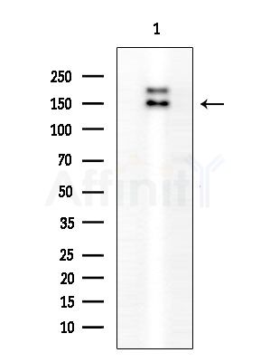 SPAG5 Antibody - Western blot analysis of extracts from EC304 cells, using SPAG5 Antibody at 1/1000 dilution.