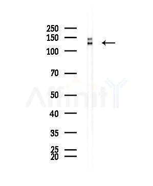 SPAG5 Antibody - Western blot analysis of lysates from EC304 cells, using SPAG5 Antibody at 1/1000 dilution.