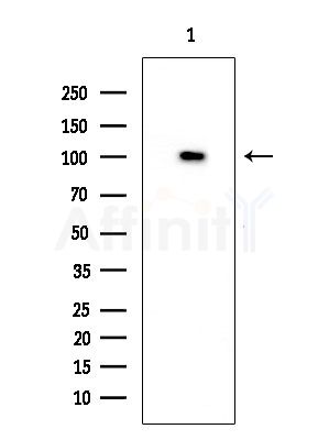 SFRS18 Antibody - Western blot analysis of extracts from EC304 cells, using SFRS18 Antibody at 1/1000 dilution.
