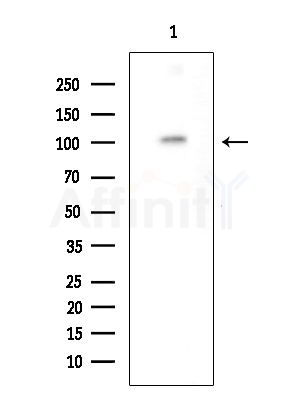 SFRS18 Antibody - Western blot analysis of extracts from Mouse brain, using SFRS18 Antibody at 1/1000 dilution.