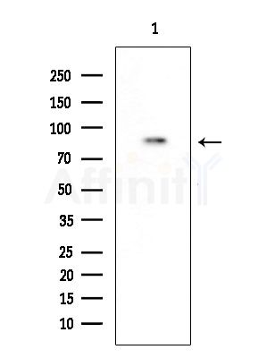 SFRS18 Antibody - Western blot analysis of extracts from COLO205 cells, using SFRS18 Antibody at 1/1000 dilution.