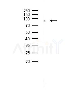 SFRS18 Antibody - Western blot analysis of lysates from COLO205 cells, using SFRS18 Antibody at 1/1000 dilution.
