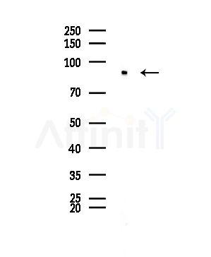 SFRS18 Antibody - Western blot analysis of lysates from EC304 cells, using SFRS18 Antibody at 1/1000 dilution.