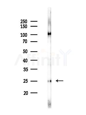 SFRS9 Antibody - Western blot analysis of lysates from MCF7 cells(heat-shock,45min treatment), using SFRS9 Antibody at 1/1000 dilution.