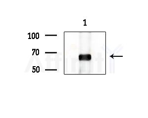 ZNF280B Antibody - Western blot analysis of extracts from HepG2 cells(starvation treatment), using ZNF280B Antibody at 1/1000 dilution.
