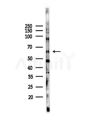 ZNF280B Antibody - Western blot analysis of lysates from HepG2 cells(starvation,24h treatment), using ZNF280B Antibody at 1/1000 dilution.