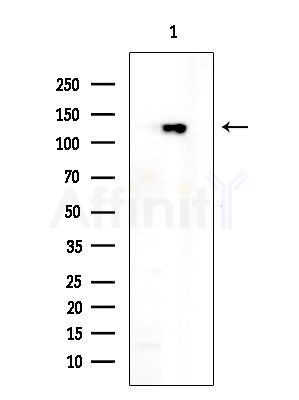 ZNF280D Antibody - Western blot analysis of extracts from EC304 cells, using ZNF280D Antibody at 1/1000 dilution.