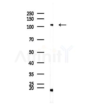 ZNF280D Antibody - Western blot analysis of lysates from EC304 cells, using ZNF280D Antibody at 1/1000 dilution.