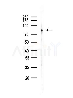 SV2C Antibody - Western blot analysis of lysates from HUVEC cells, using SV2C Antibody at 1/1000 dilution.