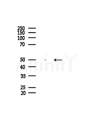 SYT10 Antibody - Western blot analysis of lysates from Hela cells(heat-shock,45min treatment), using SYT10 Antibody at 1/1000 dilution.