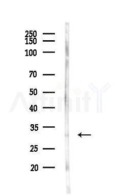 STX6 Antibody - Western blot analysis of lysates from MCF7 cells(heat-shock,45min treatment), using STX6 Antibody at 1/1000 dilution.