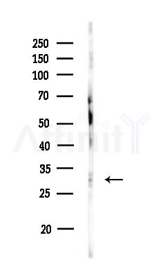 STX6 Antibody - Western blot analysis of lysates from Rat brain, using STX6 Antibody at 1/1000 dilution.