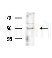 TIGD4 Antibody - Western blot analysis of extracts from various samples, using TIGD4 Antibody at 1/1000 dilution.