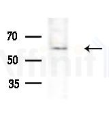TIGD4 Antibody - Western blot analysis of extracts from Mouse testis, using TIGD4 Antibody at 1/1000 dilution.