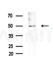 TIGD4 Antibody - Western blot analysis of extracts from Rat lung, using TIGD4 Antibody at 1/1000 dilution.