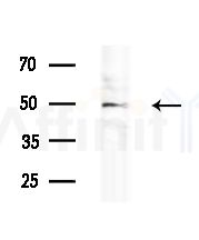 TIGD4 Antibody - Western blot analysis of extracts from 293 cells, using TIGD4 Antibody at 1/1000 dilution.
