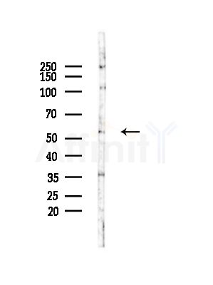 TIGD4 Antibody - Western blot analysis of lysates from RAW264.