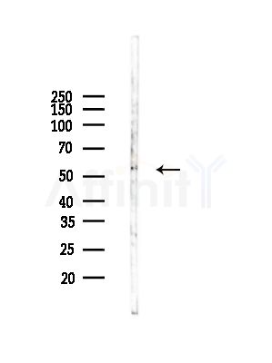 TIGD4 Antibody - Western blot analysis of lysates from Rat lung, using TIGD4 Antibody at 1/1000 dilution.