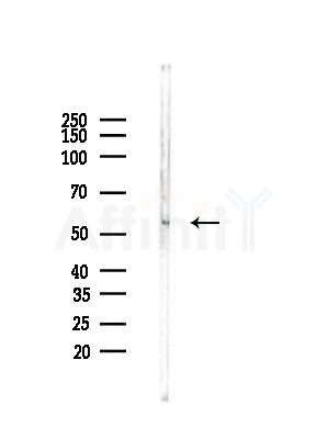 TIGD4 Antibody - Western blot analysis of lysates from Mouse testis, using TIGD4 Antibody at 1/1000 dilution.