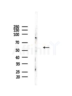 TIGD4 Antibody - Western blot analysis of lysates from HepG2 cells(LPS,4h treatment), using TIGD4 Antibody at 1/1000 dilution.