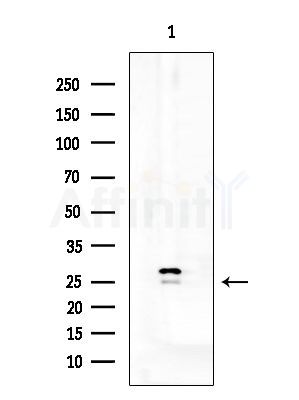 TM2D1 Antibody - Western blot analysis of extracts from EC304 cells, using TM2D1 Antibody at 1/1000 dilution.