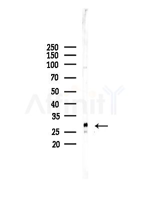 TM2D1 Antibody - Western blot analysis of lysates from EC304 cells, using TM2D1 Antibody at 1/1000 dilution.