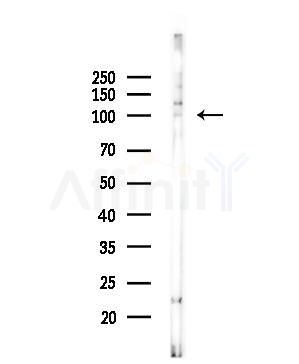 TRAK2 Antibody - Western blot analysis of lysates from EC304 cells, using TRAK2 Antibody at 1/1000 dilution.