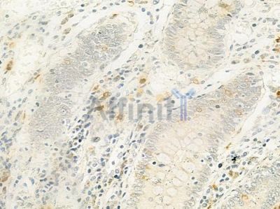 TRAPPC5 Antibody - DF9965 at 1/100 staining human normal placenta tissue by IHC-P.