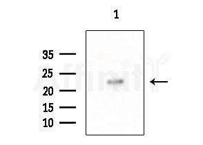 TCEAL5 Antibody - Western blot analysis of extracts from PC12 cells(LPS 4h treatment), using TCEAL5 Antibody at 1/1000 dilution.