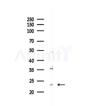 TCEAL5 Antibody - Western blot analysis of lysates from PC12 cells(LPS 4h treatment), using TCEAL5 Antibody at 1/1000 dilution.