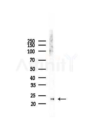 BTF3L4 Antibody - Western blot analysis of lysates from Hela cells(heat-shock, 45min treatment), using BTF3L4 Antibody at 1/1000 dilution.