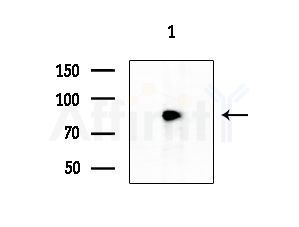 TMC7 Antibody - Western blot analysis of extracts from HUVEC cells, using TMC7 Antibody at 1/1000 dilution.