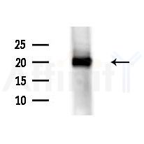 MPHOSPH10 Antibody - Western blot analysis of extracts from Mouse testis, using MPHOSPH10 Antibody at 1/1000 dilution.