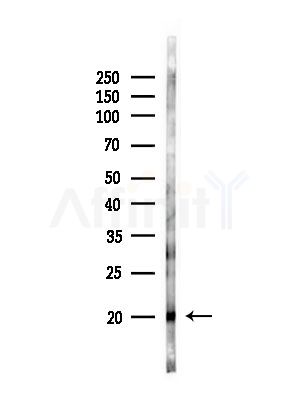 MPHOSPH10 Antibody - Western blot analysis of lysates from Mouse testis, using MPHOSPH10 Antibody at 1/1000 dilution.