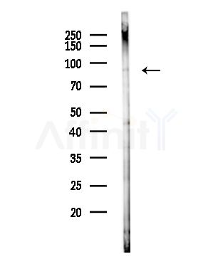 SART1 Antibody - Western blot analysis of lysates from Hela cells(starvation,24h treatment), using SART1 Antibody at 1/1000 dilution.