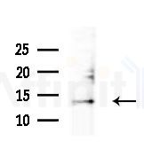LSM2 Antibody - Western blot analysis of lysates from various samples, using LSM2 Antibody at 1/1000 dilution.