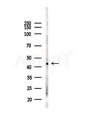 USP12 Antibody - Western blot analysis of lysates from LoVo cells(heat-shock,45min treatment), using USP12 Antibody at 1/1000 dilution.