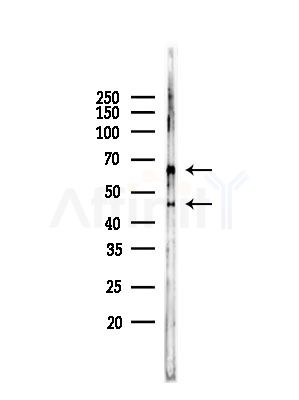 USP14 Antibody - Western blot analysis of lysates from RAW264.