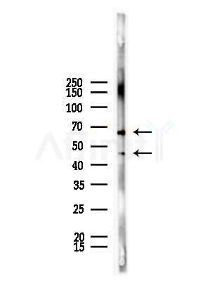 USP14 Antibody - Western blot analysis of lysates from Mouse lung, using USP14 Antibody at 1/1000 dilution.