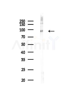 USP16 Antibody - Western blot analysis of lysates from COLO205 cells(heat-shock,45min treatment), using USP16 Antibody at 1/1000 dilution.