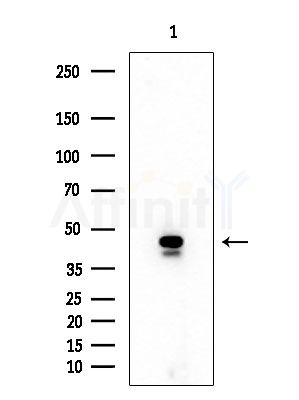 USP3 Antibody - Western blot analysis of extracts from EC304 cells, using USP3 Antibody at 1/1000 dilution.