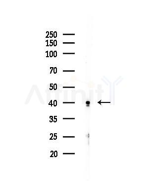USP3 Antibody - Western blot analysis of lysates from EC304 cells, using USP3 Antibody at 1/1000 dilution.