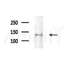 USP35 Antibody - Western blot analysis of extracts from Mouse liver, using USP35 Antibody at 1/1000 dilution.