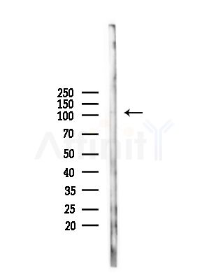 USP35 Antibody - Western blot analysis of lysates from Mouse liver, using USP35 Antibody at 1/1000 dilution.