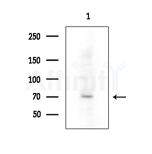 USP49 Antibody - Western blot analysis of extracts from EC304 cells, using USP49 Antibody at 1/1000 dilution.