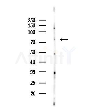 USP49 Antibody - Western blot analysis of lysates from EC304 cells, using USP49 Antibody at 1/1000 dilution.