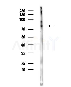 USP51 Antibody - Western blot analysis of lysates from COLO205 cells(heat-shock,45min treatment), using USP51 Antibody at 1/1000 dilution.